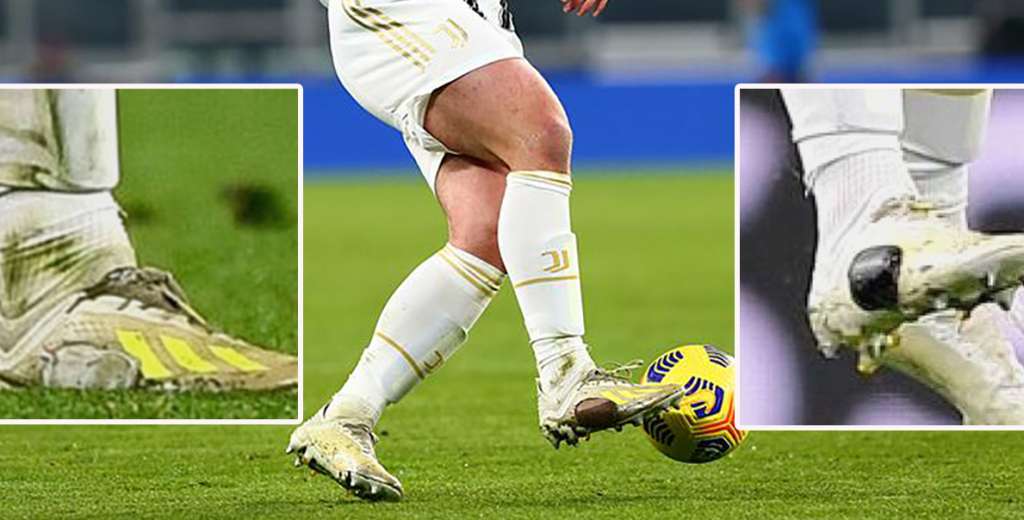 Estrella de Juventus juega con botas rotas