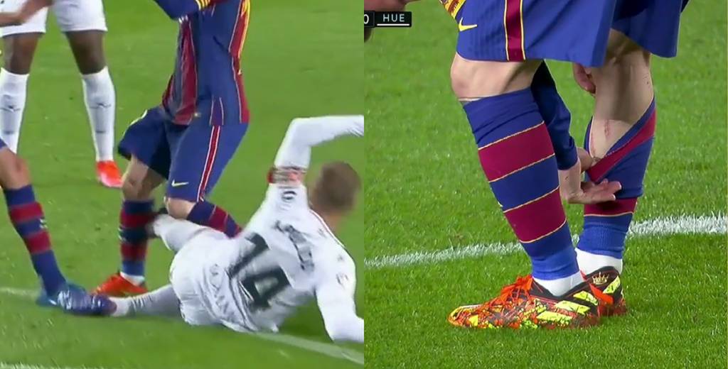 La patada que le dejó a Messi la marca en la pierna