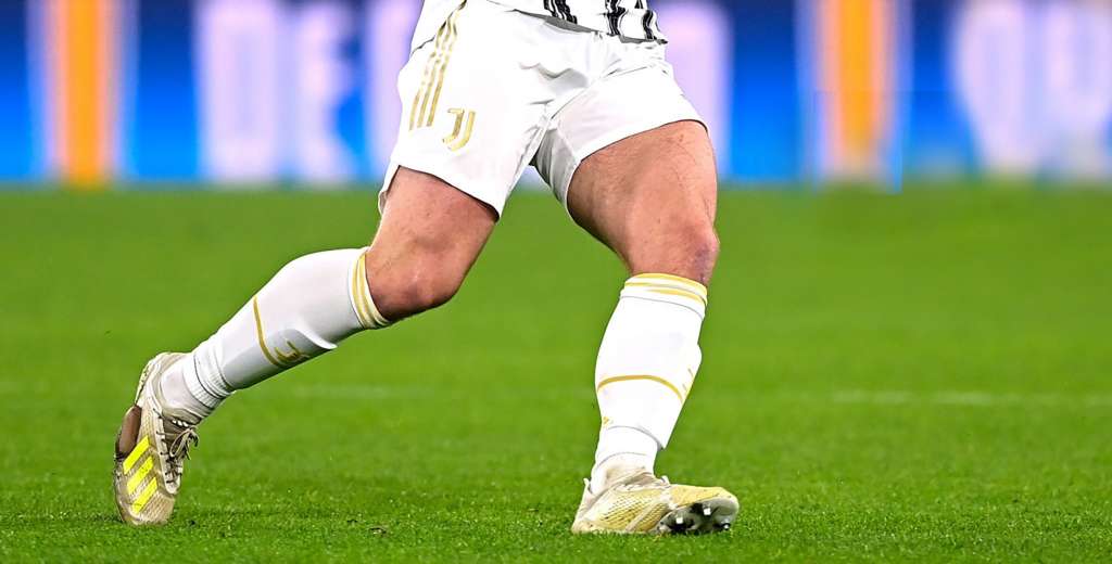 Estrella de Juventus juega con botas rotas