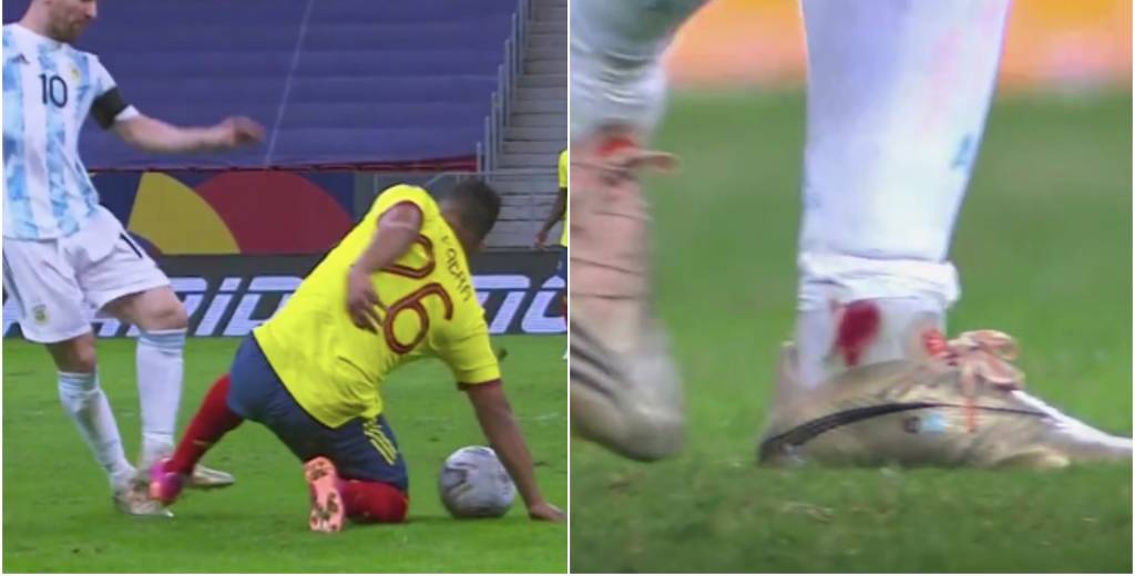 Fabra liquidó a Messi: le dejó el tobillo lleno de sangre